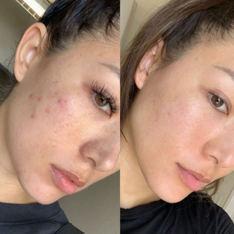 Paige Layne
Sales agent



★★★★★
Amazing facial service! My pores look smaller, and my face feels so clean and soft. The products smelled lovely and felt gentle. I noticed a difference in my complexion right away. Will return monthly!