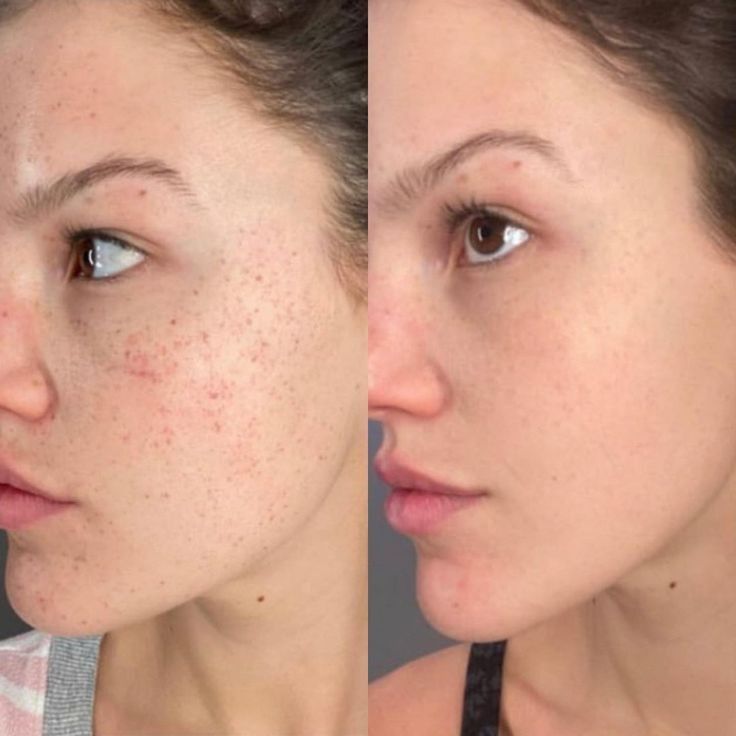 Steff Anie
Office staff



★★★★★
The facial left my skin refreshed and radiant. The spa environment was calming, and the therapist explained every step clearly. It was a pampering experience from start to finish. I loved every minute of it!